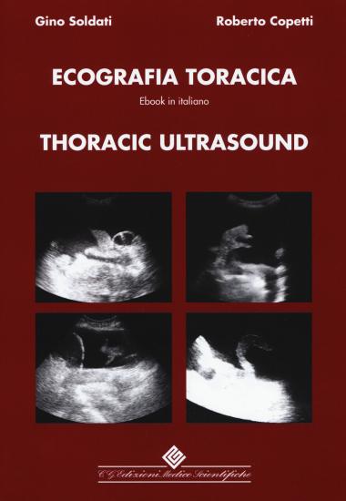 Thoracic ultrasound. Con ebook
